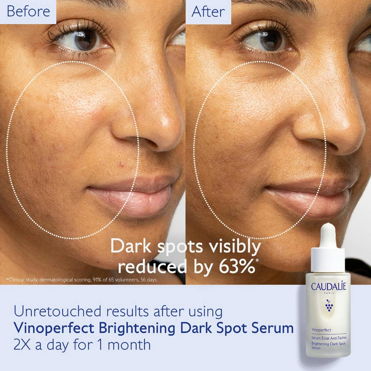 Brightening Routine Set for Dark Spots and Uneven Skin Tone