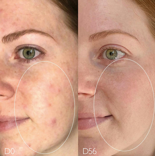 Natural Salicylic Acid Pore Minimizing Toner